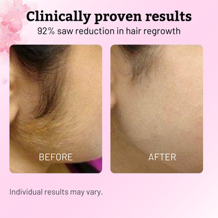 SloGrow™ Regrowth Control Serum