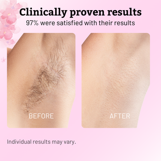 SloGrow™ Regrowth Control Serum