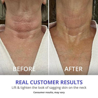 Moika™ Lissé Neck Renewal Cream