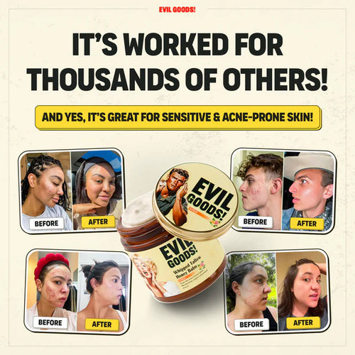 Whipped Tallow & Manuka Honey Moisturizer